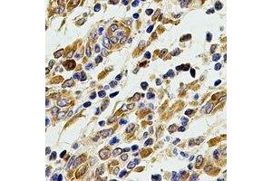 Immunohistochemical analysis of ACAD9 staining in human stomach formalin fixed paraffin embedded tissue section. (ACAD9 抗体)