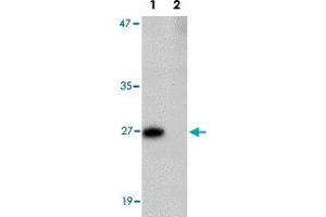 Western blot analysis of PRTFDC1 in human brain tissue lysate with PRTFDC1 polyclonal antibody  at 1 ug/mL in the (Lane 1) absence and (Lane 2) presence of blocking peptide. (PRTFDC1 抗体  (Internal Region))