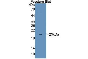 Western blot analysis of the recombinant protein. (IL1F9 抗体  (AA 5-153))