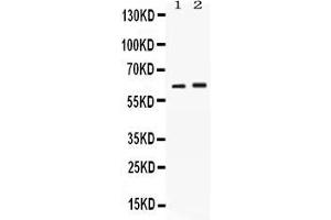 Western blot analysis of SCTR expression in rat kidney extract ( Lane 1) and SKOV3 whole cell lysates ( Lane 2). (SCTR 抗体  (C-Term))