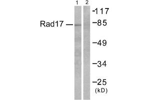 Western blot analysis of extracts from RAW264. (ABHD14A 抗体  (C-Term))