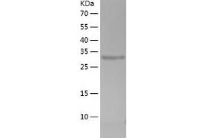 Western Blotting (WB) image for Decorin (DCN) (AA 31-359) protein (His-IF2DI Tag) (ABIN7122610)