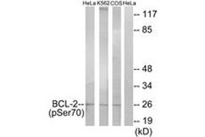 Western blot analysis of extracts from HeLa cells treated with LPS (40nM, 30mins), K562 cells treated with calyculin A (50ng/ml, 30mins) and COS-7 cells treated with H2O2 (1ng/ml, 15mins), using BCL-2 (Phospho-Ser70) Antibody. (Bcl-2 抗体  (pSer70))