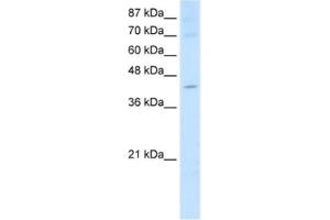 Western Blotting (WB) image for anti-Nuclear RNA Export Factor 5 (NXF5) antibody (ABIN2462318) (NXF5 抗体)