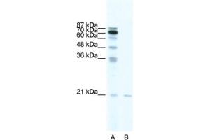 Western Blotting (WB) image for anti-SCAN Domain Containing 1 (SCAND1) antibody (ABIN2461245) (SCAND1 抗体)