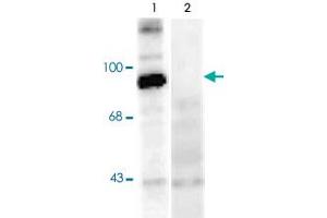 Western blot of rat hippocampal lysate stimulated with forskolin showing specific immunolabeling of the ~95k Dynamin phosphorylated at Ser774 (Control). (Dynamin 1 抗体  (pSer774))