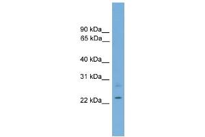 WB Suggested Anti-RBM11 Antibody Titration: 0. (RBM11 抗体  (Middle Region))