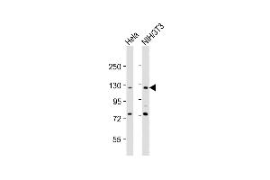 All lanes : Anti-TK Antibody (N-Term) at 1:2000 dilution Lane 1: Hela whole cell lysates Lane 2: NIH/3T3 whole cell lysates Lysates/proteins at 20 μg per lane. (AATK 抗体  (AA 55-90))