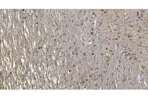 IHC analysis of Alpha B Crystallin/CRYAB using anti-Alpha B Crystallin/CRYAB antibody (ABIN7601209).