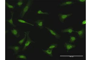 Immunofluorescence of purified MaxPab antibody to NME1 on HeLa cell. (NME1 抗体  (AA 1-177))