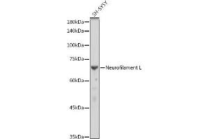 Western blot analysis of extracts of SH-SY5Y cells, using Neurofilament L antibody (ABIN7268867) at 1:10000 dilution. (NEFL 抗体)