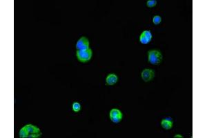 Immunofluorescence (IF) image for anti-Interleukin 23 Receptor (IL23R) (AA 15-125) antibody (ABIN7156864)