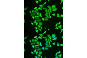 anti-Phosphoglucomutase 1 (PGM1) (AA 1-300) antibody
