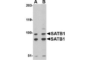 Western Blotting (WB) image for anti-SATB Homeobox 1 (SATB1) (C-Term) antibody (ABIN1030642) (SATB1 抗体  (C-Term))