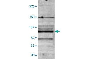 B : Western blot was performed on nuclear extracts from the U-937 (human leukemic monocyte lymphoma cell line ; 40 ug) with MBD4 polyclonal antibody , diluted 1 : 2,000 in TBST containing 3% milk powder. (MBD4 抗体)