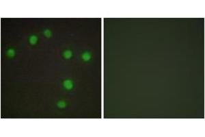 Immunofluorescence analysis of HuvEc cells, using NKX6. (NK6 Homeobox 3 抗体  (AA 161-210))