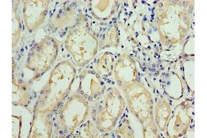 Immunohistochemistry of paraffin-embedded human kidney tissue using ABIN7171562 at dilution of 1:100 (TAF1C 抗体  (AA 70-320))