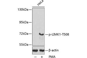 Western blot analysis of extracts from HeLa cells, using Phospho-LIMK1-T508 antibody (ABIN3020309, ABIN3020310, ABIN3020311, ABIN1681739 and ABIN7101871). (LIM Domain Kinase 1 抗体  (pThr508))