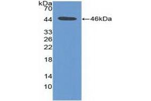 Detection of Recombinant PIM1, Human using Polyclonal Antibody to Pim-1 Oncogene (PIM1) (PIM1 抗体  (AA 129-268))