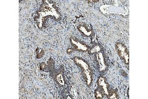 IHC analysis of RAB1B using anti-RAB1B antibody (ABIN7602809). (RAB1B 抗体  (C-Term))