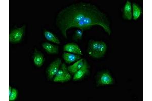 Immunofluorescent analysis of MCF-7 cells using ABIN7154424 at dilution of 1:100 and Alexa Fluor 488-congugated AffiniPure Goat Anti-Rabbit IgG(H+L) (GZMM 抗体  (AA 98-243))
