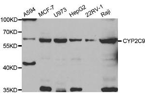 Western Blotting (WB) image for anti-Cytochrome P450, Family 2, Subfamily C, Polypeptide 9 (CYP2C9) antibody (ABIN1882346) (CYP2C9 抗体)