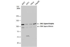 WB Image DNA ligase III antibody detects DNA ligase III protein by western blot analysis. (LIG3 抗体)