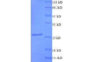 Ciliary Neurotrophic Factor (CNTF) (AA 4-196), (partial) protein (His tag)