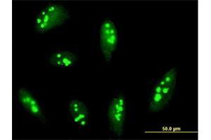 Immunofluorescence of purified MaxPab antibody to RRP12 on HeLa cell. (RRP12 抗体  (AA 1-1297))