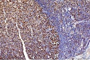 IHC analysis of FEN1 using anti-FEN1 antibody (ABIN7601618).