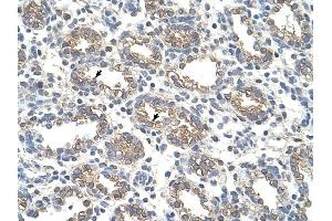 Arginase 1 antibody was used for immunohistochemistry at a concentration of 4-8 ug/ml to stain Alveolar cells (arrows) in Human Lung. (Liver Arginase 抗体  (Arg1, N-Term))