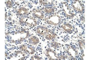 Arginase 1 antibody was used for immunohistochemistry at a concentration of 4-8 ug/ml to stain Alveolar cells (arrows) in Human Lung.