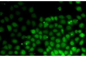 Immunofluorescence analysis of HeLa cells using HMGN2 Polyclonal Antibody (HMGN2 抗体)
