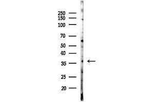 anti-CCR4-NOT Transcription Complex, Subunit 7 (CNOT7) (C-Term) antibody