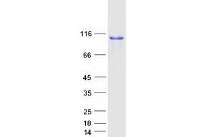Western Blotting (WB) image for Calnexin (CANX) (Transcript Variant 1) protein (Myc-DYKDDDDK Tag) (ABIN2713056)
