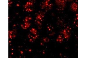 Immunofluorescence (IF) image for anti-PHD Finger Protein 6 (PHF6) (AA 125-175) antibody (ABIN7448999) (PHF6 抗体  (AA 125-175))