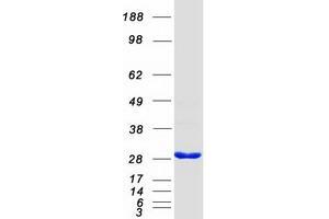 Western Blotting (WB) image for OTU Domain, Ubiquitin Aldehyde Binding 2 (OTUB2) protein (Myc-DYKDDDDK Tag) (ABIN2712338)