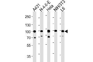 Western Blotting (WB) image for anti-Heat Shock Protein 90kDa alpha (Cytosolic), Class B Member 1 (HSP90AB1) (AA 697-724), (C-Term) antibody (ABIN652406)