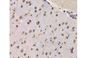 Immunohistochemistry of paraffin-embedded Mouse brain using RAD1 Polyclonal Antibody at dilution of 1:200 (40x lens).