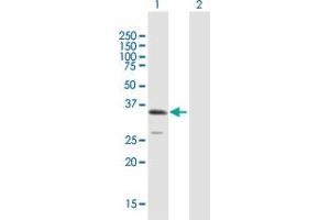 Western Blot analysis of ULBP1 expression in transfected 293T cell line by ULBP1 MaxPab polyclonal antibody. (ULBP1 抗体  (AA 1-244))