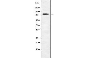 Western blot analysis of MAGE1 using K562 whole cell lysates (MAGEE1 抗体  (Internal Region))