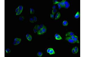 Immunofluorescent analysis of MCF-7 cells using ABIN7156574 at dilution of 1:100 and Alexa Fluor 488-congugated AffiniPure Goat Anti-Rabbit IgG(H+L) (IFI27L2 抗体  (AA 87-130))