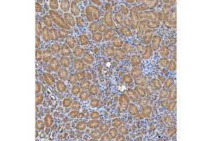 IHC analysis of SLC20A1 using anti-SLC20A1 antibody (ABIN7602463).