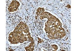 IHC analysis of SNRPN using anti-SNRPN antibody (ABIN3043934).
