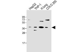 All lanes : Anti-FCGRT Antibody (C-term) at 1:500 dilution Lane 1: HepG2 whole cell lysate Lane 2: THP-1 whole cell lysate Lane 3: Human lung lysate Lane 4: COLO 205 whole cell lysate Lysates/proteins at 20 μg per lane. (FcRn 抗体  (C-Term))