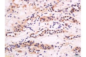 Formalin-fixed and paraffin embedded human kidney labeled with Anti-CXCL14 Polyclonal Antibody, Unconjugated  at 1:200 followed by conjugation to the secondary antibody and DAB staining. (CXCL14 抗体  (AA 51-99))