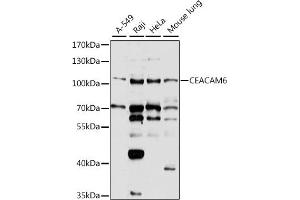 Western blot analysis of extracts of various cell lines, using CE antibody  at 1:1000 dilution. (CEACAM6 抗体  (AA 200-320))