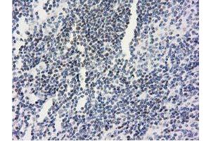 Image no. 1 for anti-Ankyrin Repeat Domain 53 (ANKRD53) (AA 1-300) antibody (ABIN1490718) (ANKRD53 抗体  (AA 1-300))