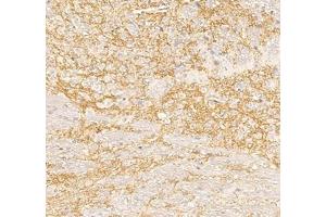 Immunohistochemistry analysis of paraffin embedded mouse cerebellum using Nrg4 (ABIN7074805) at dilution of 1: 300 (Neuregulin 4 抗体)
