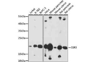 Western blot analysis of extracts of various cells, using SSR3 antibody (ABIN7270298) at 1:1000 dilution. (SSR3 抗体  (AA 70-145))